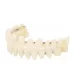  Protesi in resina per denti A2