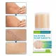 Cerotti in Silicone West&Month per Cicatrici - Efficacia Dermatologicamente Testata